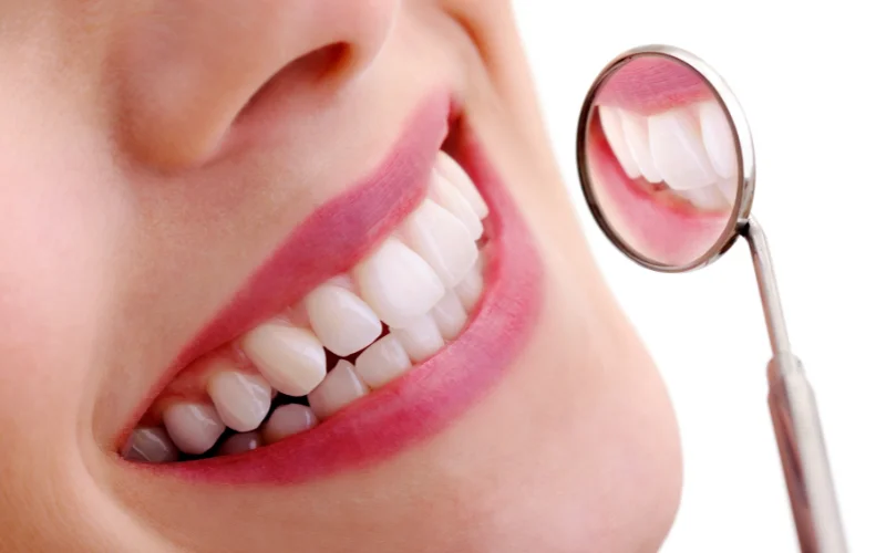 Smile Makeover Services - Precious Implant Dental Studio