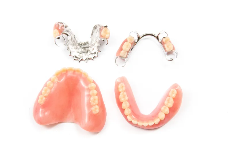 Snap-On Dentures Services - Precious Implant Dental Studio