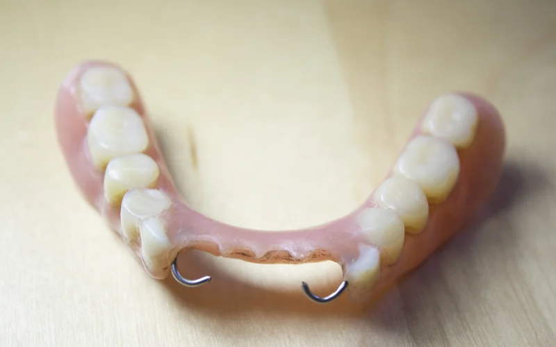 Snap-On Dentures Services - Precious Implant Dental Studio